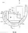 Fig. 07 - KNEE REPLACEMENT IMPLANT HAVING STACKABLE SPACERS