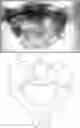 Fig. 01 - Artificial spinal prosthesis and method