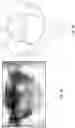 Fig. 02 - Artificial spinal prosthesis and method