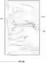 Fig. 25 - Artificial spinal prosthesis and method