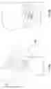 Fig. 40 - Artificial spinal prosthesis and method