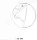 Fig. 45 - Artificial spinal prosthesis and method