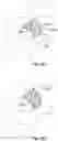 Fig. 49 - Artificial spinal prosthesis and method