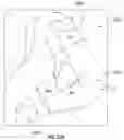 Fig. 51 - Artificial spinal prosthesis and method