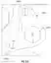 Fig. 53 - Artificial spinal prosthesis and method