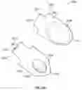 Fig. 55 - Artificial spinal prosthesis and method