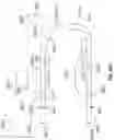Fig. 57 - Artificial spinal prosthesis and method