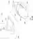 Fig. 58 - Artificial spinal prosthesis and method