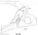 Fig. 69 - Artificial spinal prosthesis and method