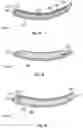 Fig. 15 - Prosthetic foot with layers of fibrous material