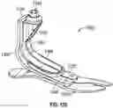 Fig. 35 - Prosthetic foot with layers of fibrous material