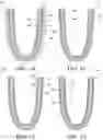 Fig. 06 - Liner for prosthetic and orthopedic systems