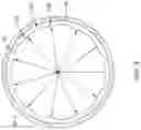Fig. 04 - Stent with improved deployment characteristics