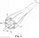Fig. 05 - Balloon expandable endoprosthesis