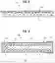 Fig. 05 - Expandable sheath