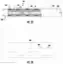 Fig. 13 - Expandable sheath