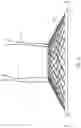 Fig. 03 - Single member intraluminal device and method of fixation