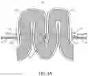 Fig. 05 - Single member intraluminal device and method of fixation