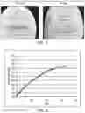 Fig. 07 - BIOERODIBLE OCULAR DRUG DELIVERY INSERT AND THERAPEUTIC METHOD