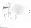 Fig. 11 - Methods for lenticular laser incision