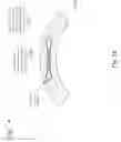 Fig. 13 - Methods for lenticular laser incision