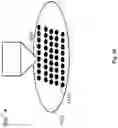 Fig. 16 - Methods for lenticular laser incision