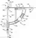 Fig. 01 - TOOLS AND METHODS FOR DACRYOCYSTORHINOSTOMY
