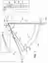 Fig. 02 - TOOLS AND METHODS FOR DACRYOCYSTORHINOSTOMY