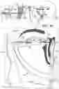 Fig. 10 - TOOLS AND METHODS FOR DACRYOCYSTORHINOSTOMY