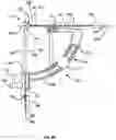 Fig. 19 - TOOLS AND METHODS FOR DACRYOCYSTORHINOSTOMY