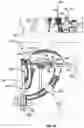 Fig. 23 - TOOLS AND METHODS FOR DACRYOCYSTORHINOSTOMY