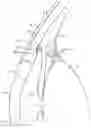 Fig. 01 - Intraocular implants and related kits and methods