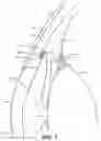 Fig. 02 - Intraocular implants and related kits and methods