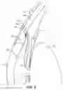 Fig. 03 - Intraocular implants and related kits and methods