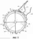 Fig. 04 - Intraocular implants and related kits and methods