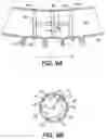 Fig. 10 - Intraocular implants and related kits and methods