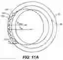 Fig. 12 - Intraocular implants and related kits and methods