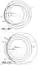 Fig. 13 - Intraocular implants and related kits and methods