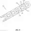 Fig. 38 - Intraocular implants and related kits and methods