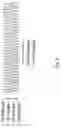 Fig. 06 - SYSTEMS AND METHODS FOR LENTICULAR LASER INCISION