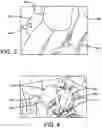 Fig. 03 - Bodily Transfer and Lifting Device