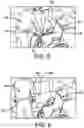 Fig. 04 - Bodily Transfer and Lifting Device