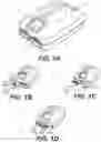 Fig. 02 - PNEUMATIC COMPRESSION SYSTEMS AND COMPRESSION TREATMENT METHODS