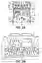 Fig. 03 - PNEUMATIC COMPRESSION SYSTEMS AND COMPRESSION TREATMENT METHODS