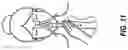 Fig. 11 - PAIN MANAGEMENT DEVICE AND METHOD OF USE