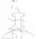 Fig. 08 - SUBCUTANEOUS TISSUE THERAPY TREATMENT METHOD