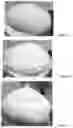 Fig. 03 - MOUSSE PRODUCTS, METHODS AND DEVICES
