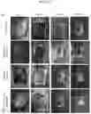 Fig. 22 - COMPOSITIONS AND METHODS OF USE FOR TREATMENT OR IMPROVEMENT OF THE CONDITION AND APPEARANCE OF SKIN