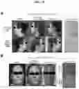 Fig. 42 - COMPOSITIONS AND METHODS OF USE FOR TREATMENT OR IMPROVEMENT OF THE CONDITION AND APPEARANCE OF SKIN