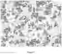 Fig. 06 - Liposomes encapsulating adenosine